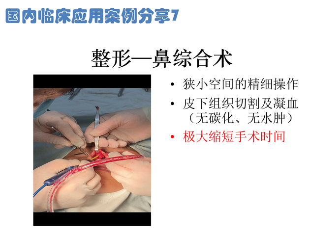 低溫射頻刀整形鼻綜合術應用